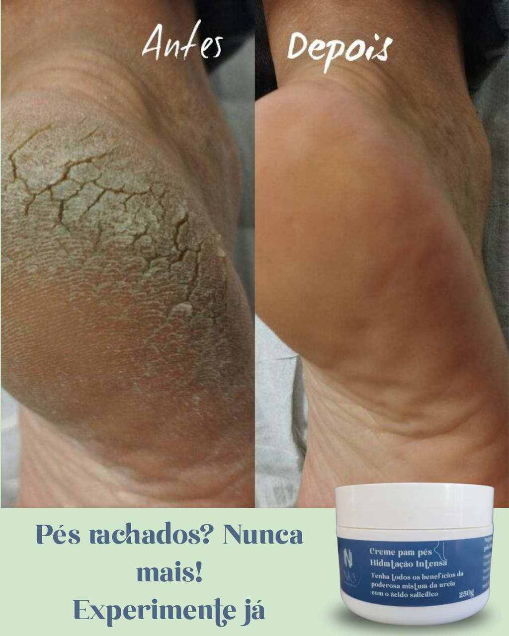 Creme para Pés - Intense Care